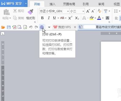 惠普m454dw怎么双面打印