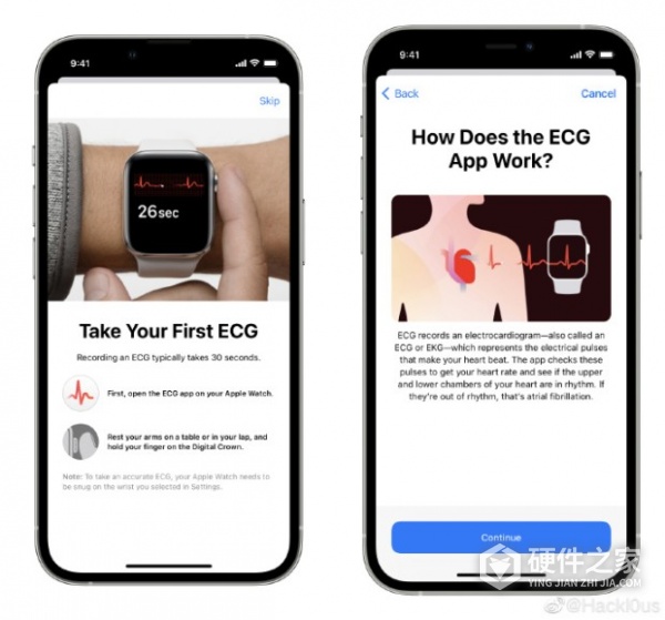 Apple Watch ECG 心电图功能介绍