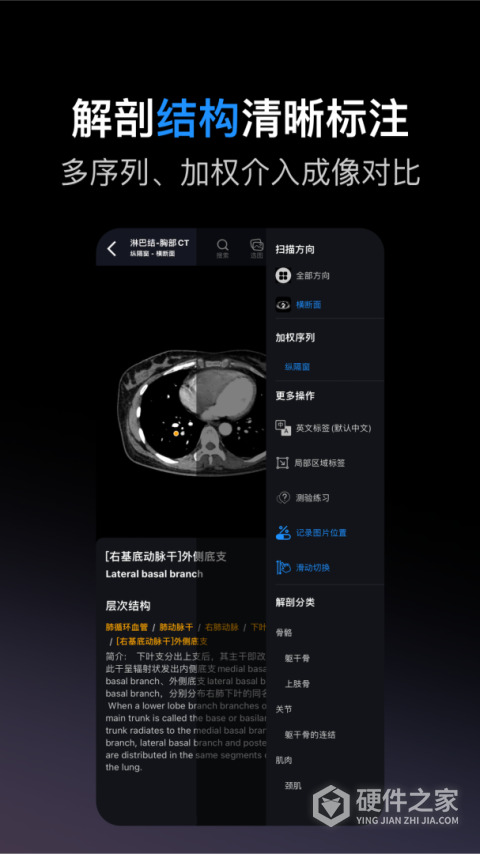 影像解剖图谱app